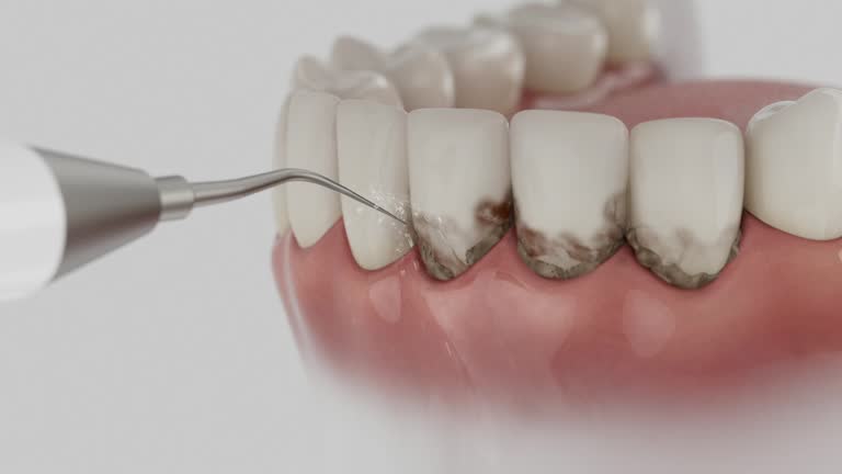 Reliable Dental contractor in Willcox, AZ by Smile Center Dentistry